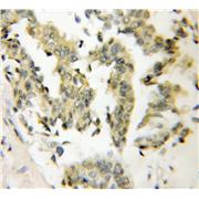 SMYD3 Rabbit Polyclonal Antibody (12011-1-AP)