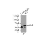 ST7 Rabbit Polyclonal Antibody (11945-1-AP)