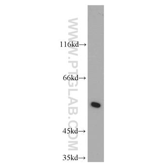 LRDD Rabbit Polyclonal Antibody (12119-1-AP)
