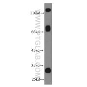Galc Rabbit Polyclonal Antibody (11991-1-AP)