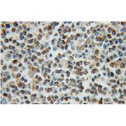 ARL15 Rabbit Polyclonal Antibody (11934-1-AP)