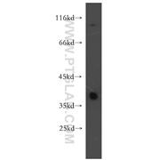 TSPAN5 Rabbit Polyclonal Antibody (12122-1-AP)