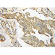TRIM6 Rabbit Polyclonal Antibody (11953-1-AP)