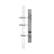 DTX3L Rabbit Polyclonal Antibody (11963-1-AP)