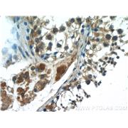 HSFY1 Rabbit Polyclonal Antibody (11970-1-AP)