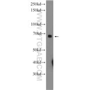 PTPN9 Rabbit Polyclonal Antibody (12109-1-AP)