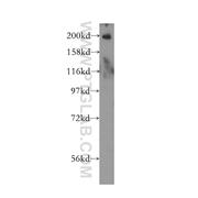 RBBP6 Rabbit Polyclonal Antibody (11882-1-AP)
