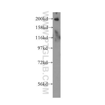 RBBP6 Rabbit Polyclonal Antibody (11882-1-AP)