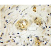 RHCG Rabbit Polyclonal Antibody (11949-1-AP)