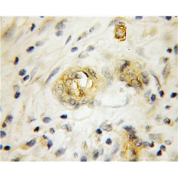 RHCG Rabbit Polyclonal Antibody (11949-1-AP)