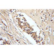 ERGIC2 Rabbit Polyclonal Antibody (11927-1-AP)