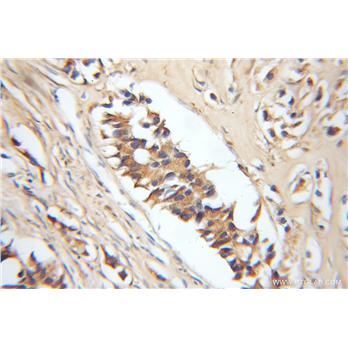 ERGIC2 Rabbit Polyclonal Antibody (11927-1-AP)