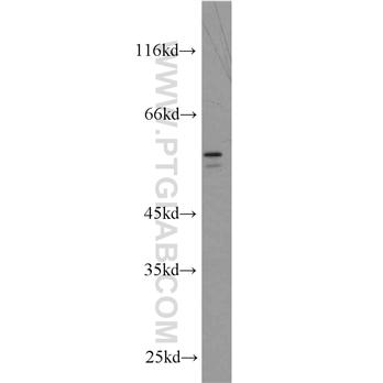 BRF2 Rabbit Polyclonal Antibody (12056-1-AP)