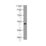 TINAGL1 Rabbit Polyclonal Antibody (12077-1-AP)
