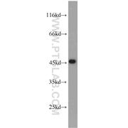 UBA5 Rabbit Polyclonal Antibody (12093-1-AP)