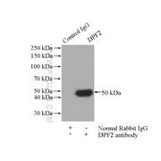 DPF2 Rabbit Polyclonal Antibody (12111-1-AP)