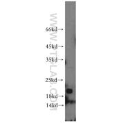NBL1 Rabbit Polyclonal Antibody (12069-1-AP)
