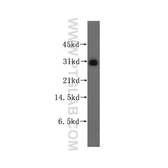 FKBP7 Rabbit Polyclonal Antibody (12092-1-AP)