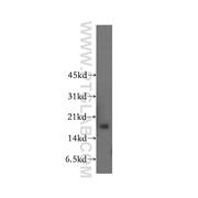NCBP2 Rabbit Polyclonal Antibody (11950-1-AP)