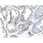CCNE2 Rabbit Polyclonal Antibody (11935-1-AP)