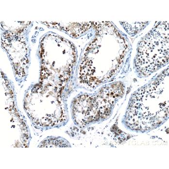 CCNE2 Rabbit Polyclonal Antibody (11935-1-AP)