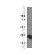 GAS2 Rabbit Polyclonal Antibody (11941-2-AP)