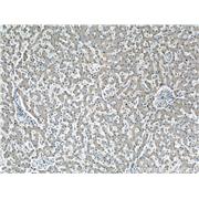 AGT Rabbit Polyclonal Antibody (11992-1-AP)