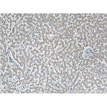 AGT Rabbit Polyclonal Antibody (11992-1-AP)