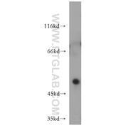 HOXC10 Rabbit Polyclonal Antibody (12025-1-AP)