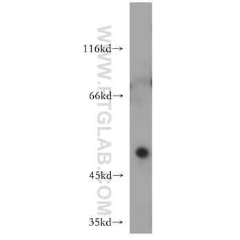 HOXC10 Rabbit Polyclonal Antibody (12025-1-AP)