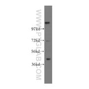 TIPIN Rabbit Polyclonal Antibody (11972-2-AP)