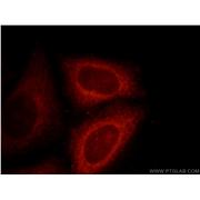 DNAJC2 Rabbit Polyclonal Antibody (11971-1-AP)