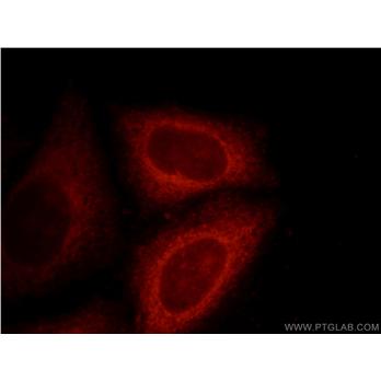 DNAJC2 Rabbit Polyclonal Antibody (11971-1-AP)
