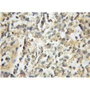 PSMA3 Rabbit Polyclonal Antibody (11887-1-AP)