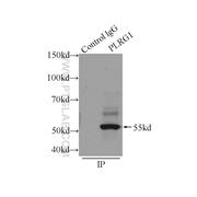 PLRG1 Rabbit Polyclonal Antibody (11914-1-AP)
