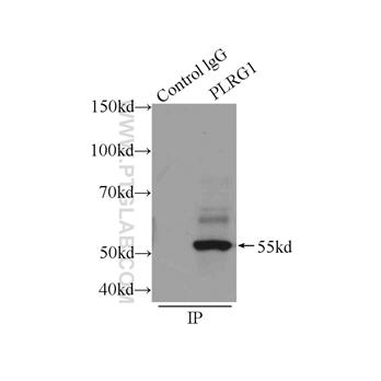 PLRG1 Rabbit Polyclonal Antibody (11914-1-AP)