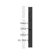 SNAI2 Rabbit Polyclonal Antibody (12129-1-AP)