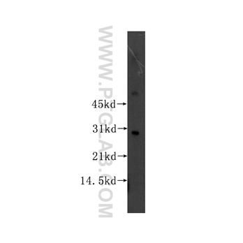 SNAI2 Rabbit Polyclonal Antibody (12129-1-AP)