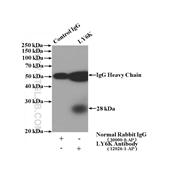 LY6K Rabbit Polyclonal Antibody (12026-1-AP)