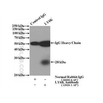 LY6K Rabbit Polyclonal Antibody (12026-1-AP)