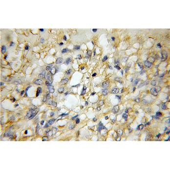 GPR137 Rabbit Polyclonal Antibody (11929-1-AP)