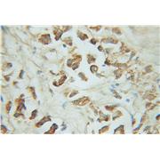 TM7SF2 Rabbit Polyclonal Antibody (12033-1-AP)