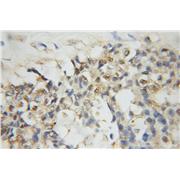RAD23B Rabbit Polyclonal Antibody (12121-1-AP)