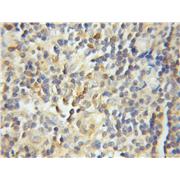 GRAP2 Rabbit Polyclonal Antibody (11894-1-AP)