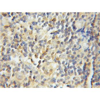 GRAP2 Rabbit Polyclonal Antibody (11894-1-AP)