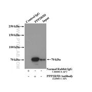 PPP2R5D Rabbit Polyclonal Antibody (12068-1-AP)