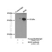 RGR Rabbit Polyclonal Antibody (11904-1-AP)