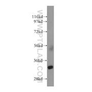 NHEJ1 Rabbit Polyclonal Antibody (11888-1-AP)