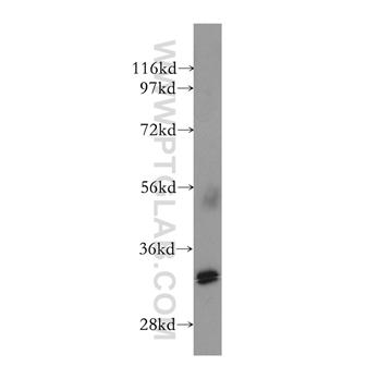 NHEJ1 Rabbit Polyclonal Antibody (11888-1-AP)