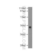 PADI2 Rabbit Polyclonal Antibody (12110-1-AP)